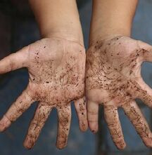 tangan kotor penyebab cacingan pada anak