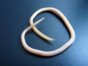 Cacing gelang manusia diekstraksi dari tubuh