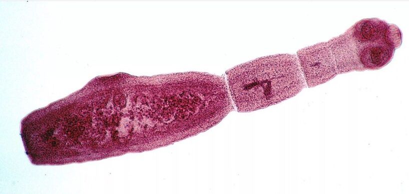 Echinococcus adalah salah satu parasit paling berbahaya bagi manusia