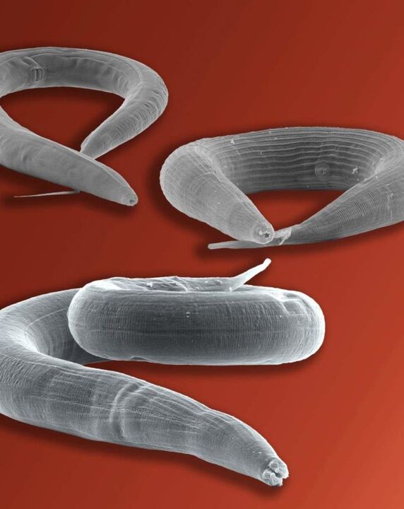 parasit cacing kremi yang hidup di usus