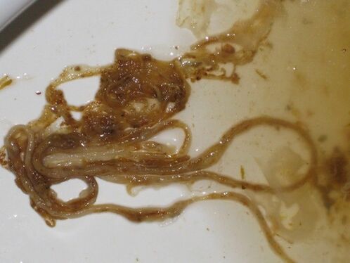 cacing parasit dari tubuh manusia
