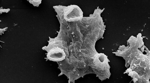 Negleria fowlera adalah parasit protozoa yang berbahaya bagi kehidupan manusia. 