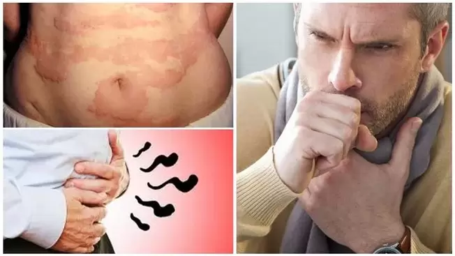 Alergi, batuk dan kembung adalah tanda-tanda kerusakan tubuh oleh cacing