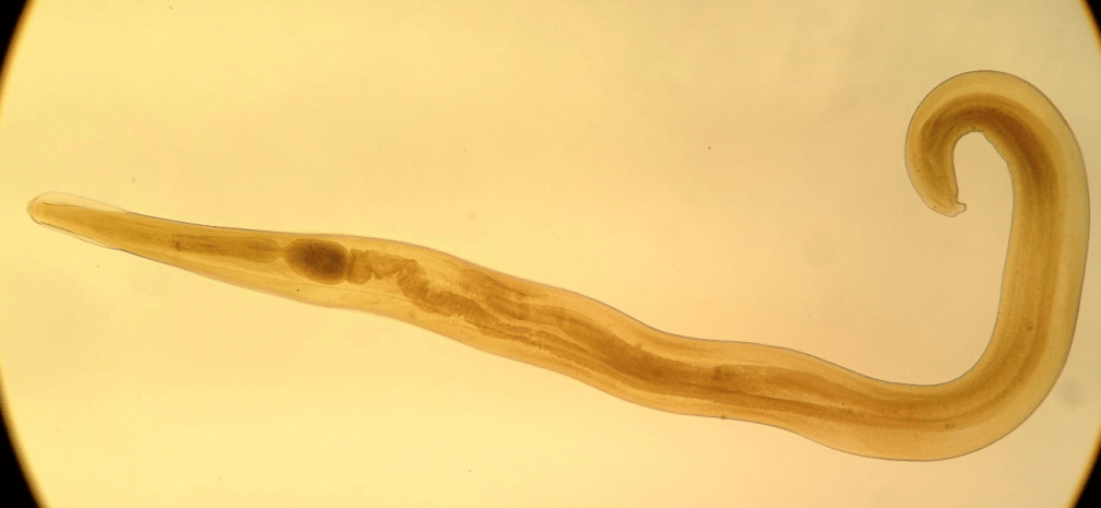 Cacing kremi adalah parasit umum pada anak-anak. 